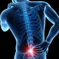 30T thoát vị đĩa đệm L5